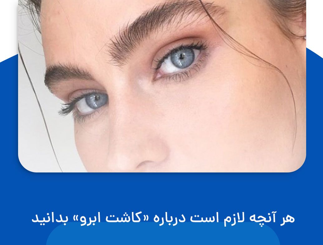 کاشت ابرو