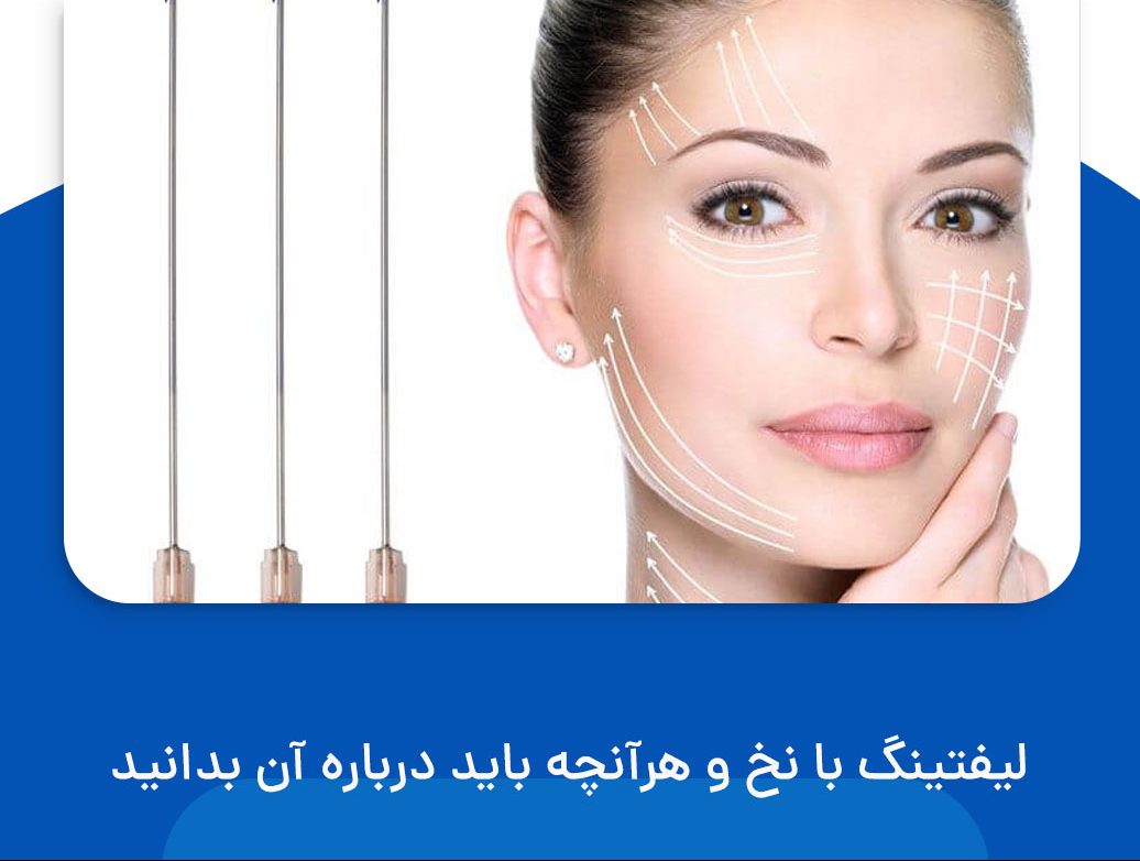 لیفتینگ با نخ چیست؟