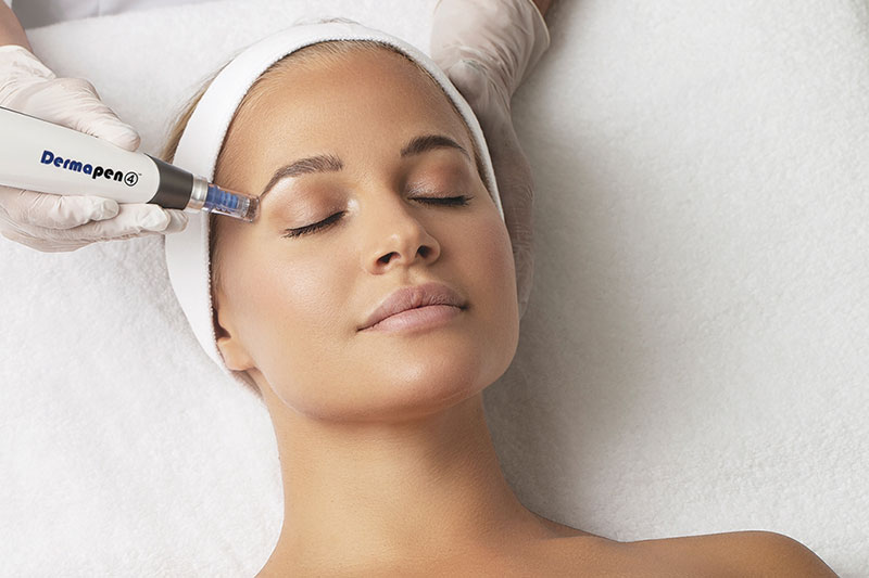 مزایا میکرونیدلینگ