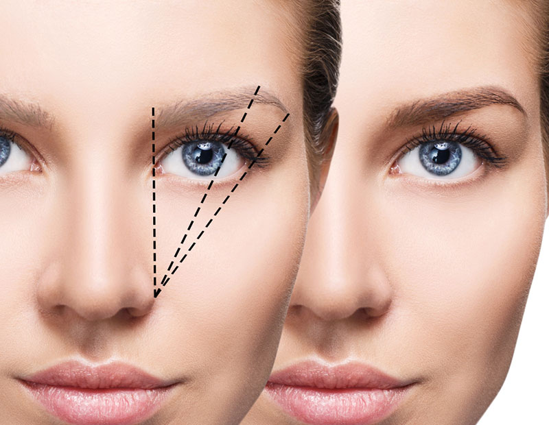 نحوه کاشت ابرو