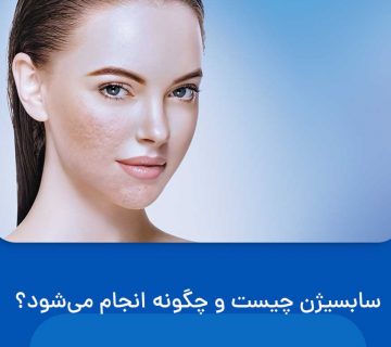 سابسیژن چیست