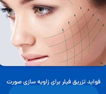 زاویه سازی صورت