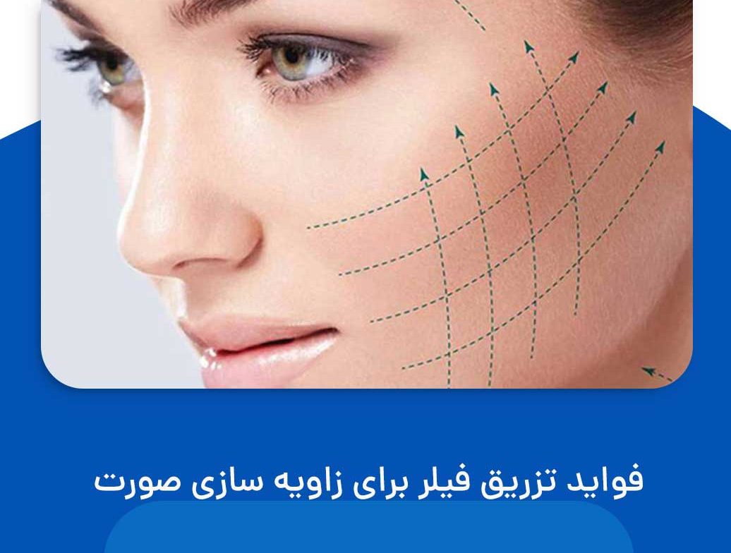 زاویه سازی صورت