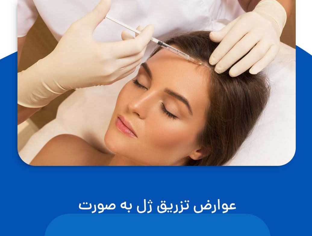 عوارض تزريق ژل به صورت