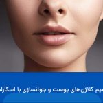 جوانسازی با اسکارلت