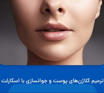 جوانسازی با اسکارلت