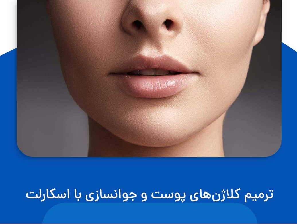 جوانسازی با اسکارلت